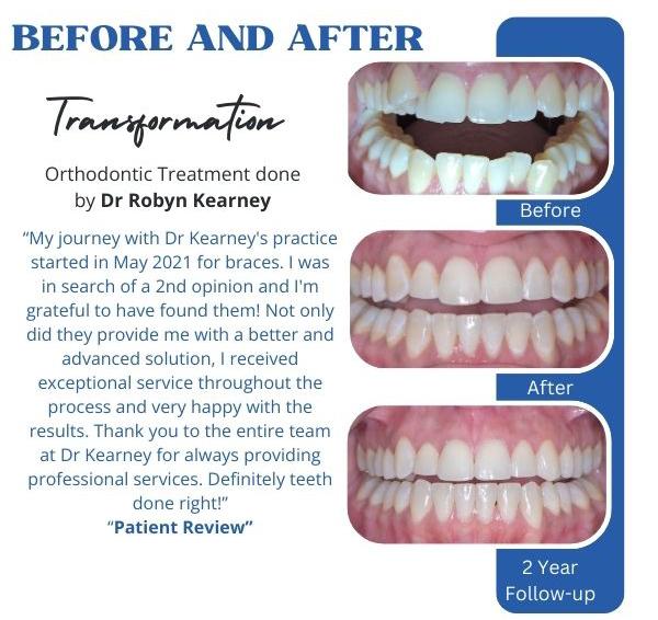 Before After_October