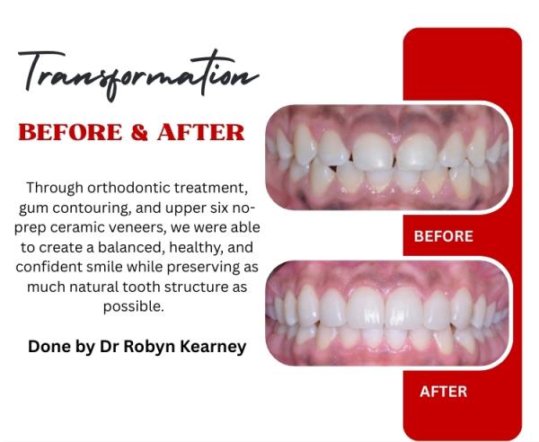 February Mailer 2026