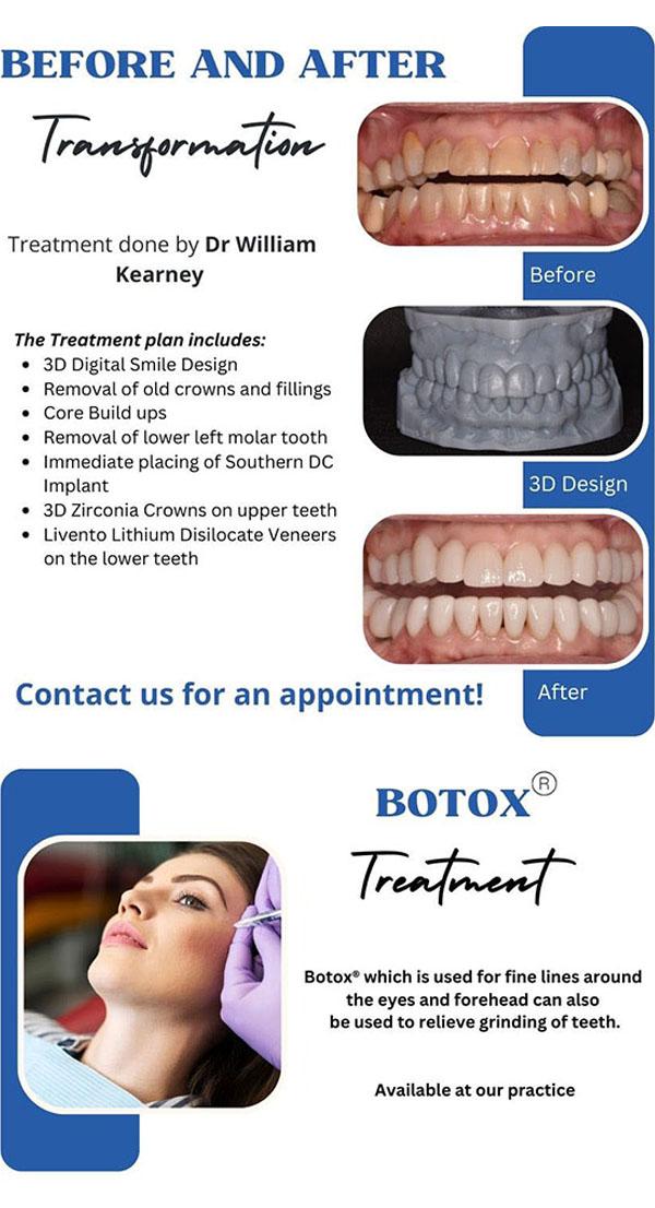 BeforeAfter_November