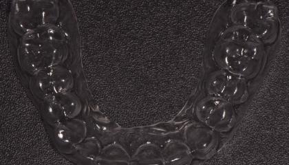 Clear aligner