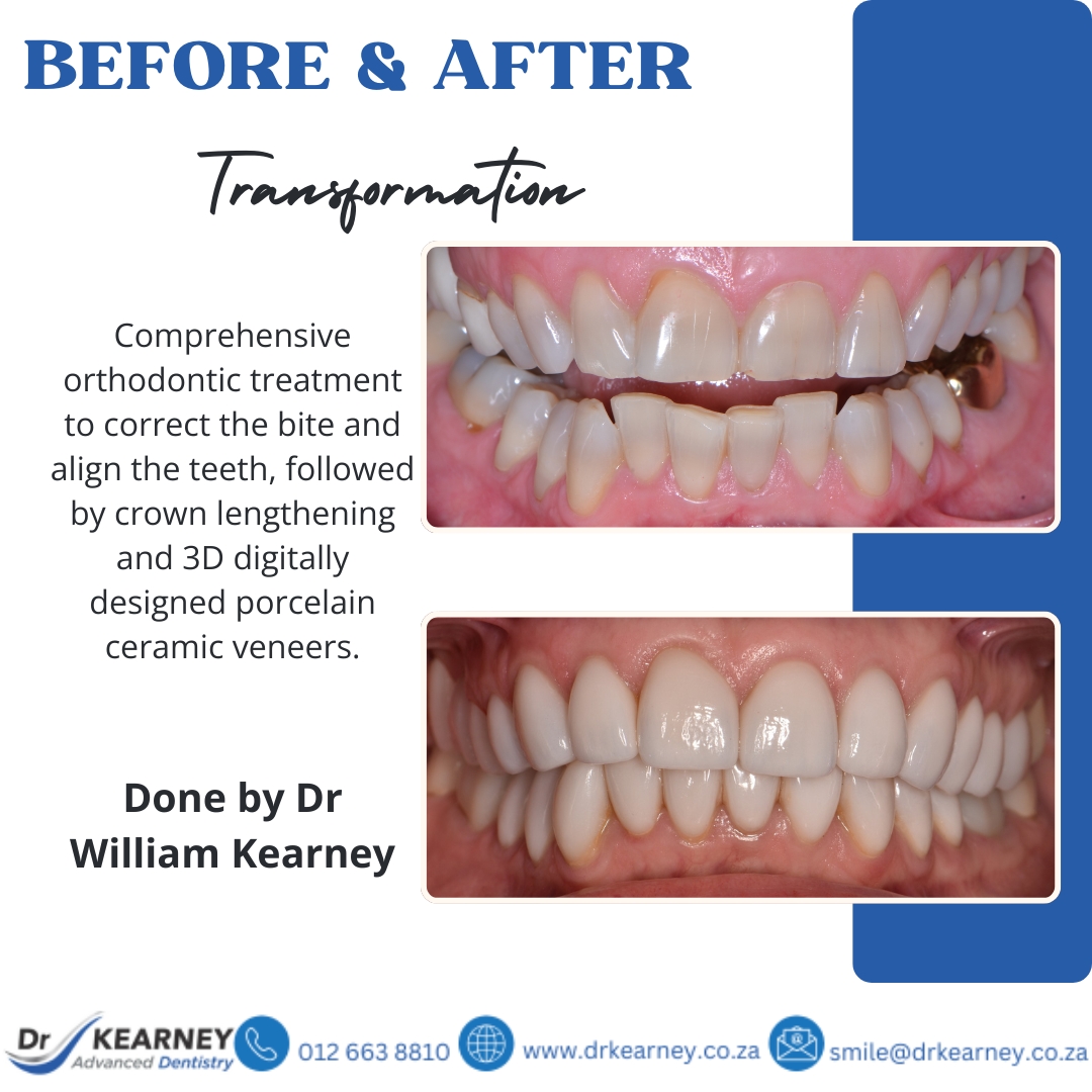Before-After-July-2026.jpg